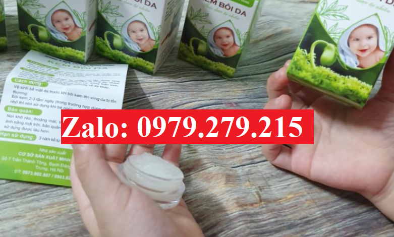 Kem bôi da Minh Hùng có bán online không? Xem ngay